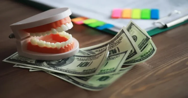 Veneers Cost