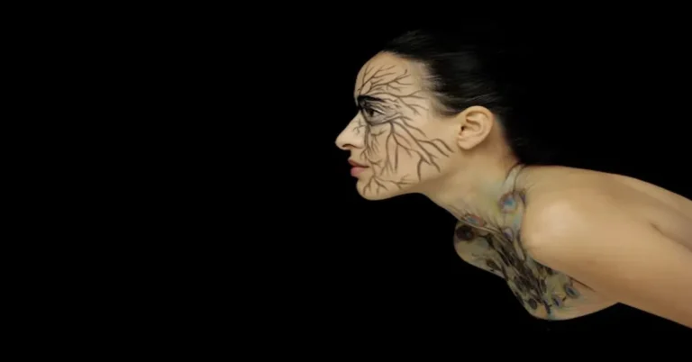 Tattoo Removal